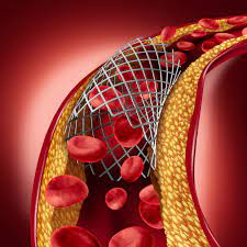 Demystifying Cholesterol